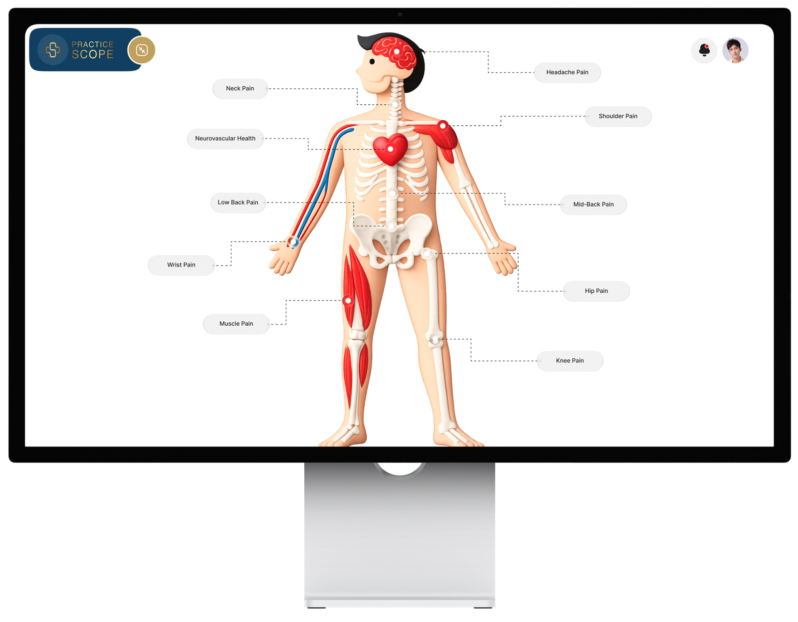 Practice Scope pain body map